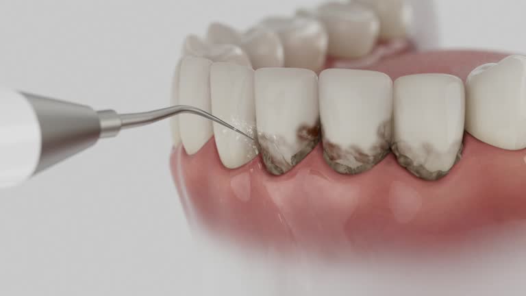 Trusted Invisalign Clear Aligners service in Reiffton, PA - Dentist Open Now